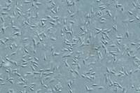 Oursin - Spermatozoïdes d'Oursin x100 